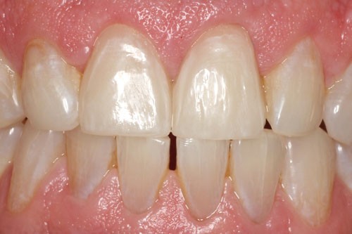 cerec6