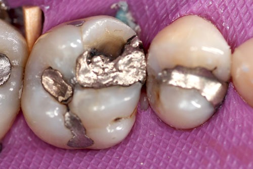 cerec8